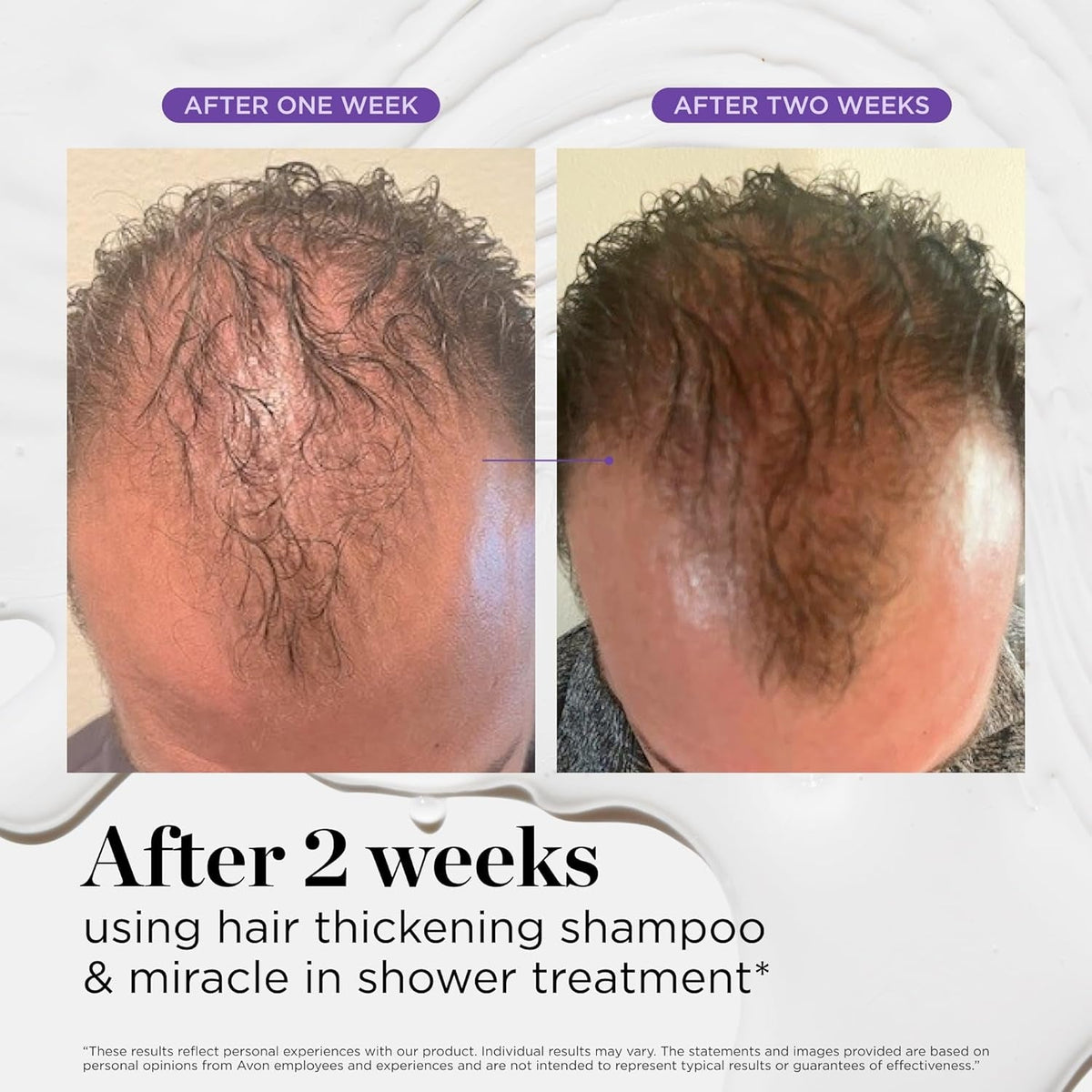 Miracle in Shower Moisturizing Treatment for Hair Loss, Korean Hair Care Rinse, Rosemary Oil for Smooth, Healthier-Looking Hair in 5 Seconds, Scalp Revitalizing Solution