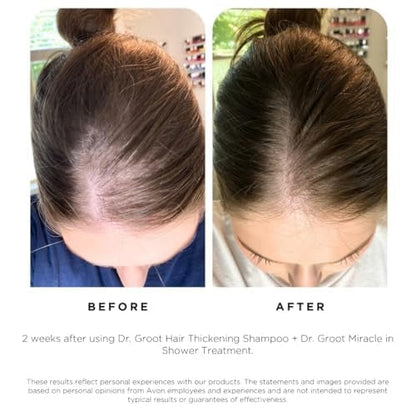 Hair Thickening Shampoo, Korean Hair Care with Biotin, Rosemary Oil to Help Volumize Thinning, Damaged Hair, Hydrate Hair and Scalp, Biotin Shampoo, Scalp Revitalizing Solution