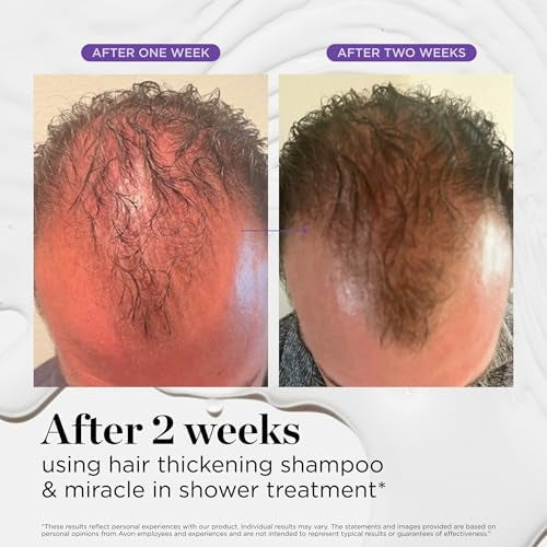 Hair Thickening Shampoo, Korean Hair Care with Biotin, Rosemary Oil to Help Volumize Thinning, Damaged Hair, Hydrate Hair and Scalp, Biotin Shampoo, Scalp Revitalizing Solution